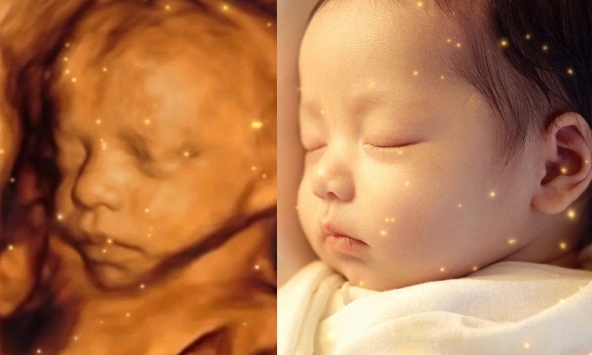 Trào lưu dùng AI “dự đoán gương mặt em bé” từ ảnh siêu âm gây tranh cãi