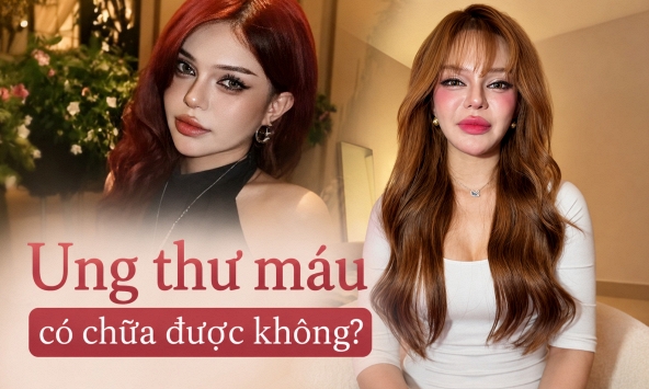 TikToker Đan Thy thông báo mắc ung thư máu ở tuổi 23: Ung thư máu có chữa được không?