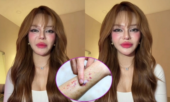 Video lúc nửa đêm của TikToker 11 triệu người theo dõi khiến nhiều người giật mình: Ung thư máu có đến từ thói quen thức khuya, uống trà sữa?