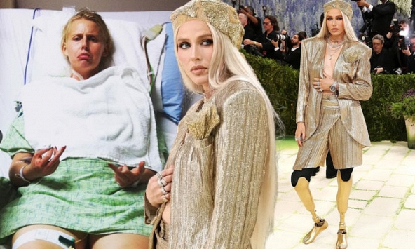 Nữ người mẫu bị cắt cụt chân, 14 năm sau mang chân giả đến đại náo Met Gala