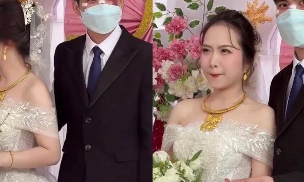 Chú rể đeo khẩu trang, mặt đầy vết thương trong ngày cưới ở TP.HCM: Lý do phía sau