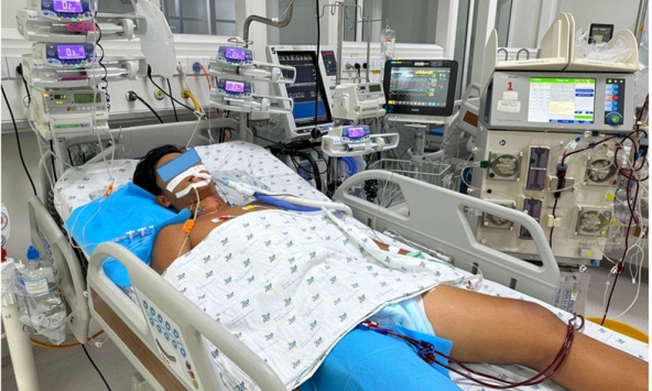 Đá bóng dưới nắng nóng, nam sinh 15 tuổi bị sốc nhiệt, suy gan thận