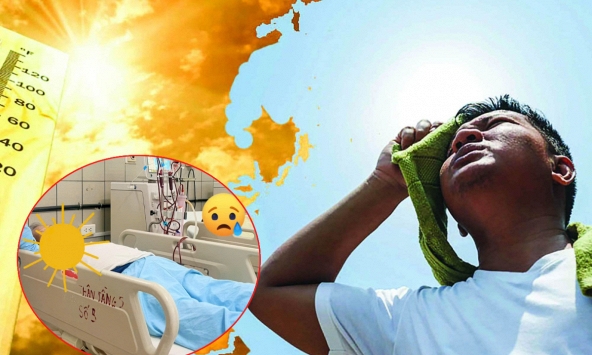 Nam thanh niên bị suy thận do làm việc dưới trời nắng mà không uống đủ nước: BS BV Bạch Mai cảnh báo 4 dấu hiệu cần đi viện ngay