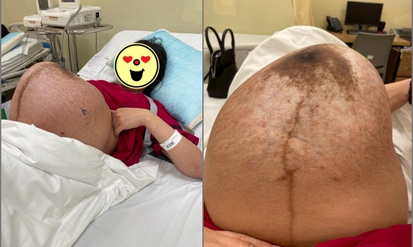 Chiếc bụng của mẹ bầu mang thai đôi khiến ai nhìn cũng xót thay, thế nhưng sinh xong chưa kịp nghỉ ngơi thì thử thách mới chính thức bắt đầu
