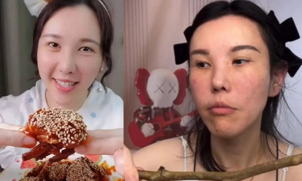 Mặt cô gái trẻ biến dạng sau 2 năm làm mukbang, bác sĩ cảnh báo 4 cái giá phải trả về sức khỏe ít ai biết đến