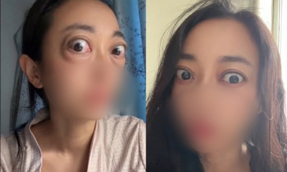 Nhìn đôi mắt 'ếch' của người phụ nữ, ai cũng thương, câu chuyện phía sau là bài học cảnh tỉnh nhiều người trẻ