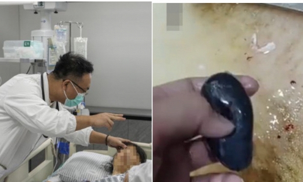 Người phụ nữ suy gan cấp vì mẹo dân gian chữa đau đầu, bác sĩ nói thẳng: Phần này của cá độc hơn thạch tín!