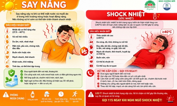 Đau đầu do nắng nóng, khi nào cần nhập viện?