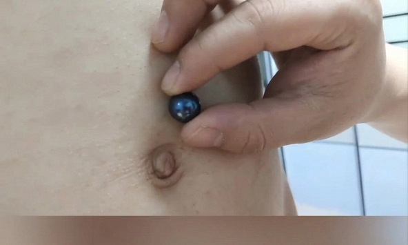 Trẻ 3 tuổi nuốt phải bi nam châm, mẹ nảy 'cao kiến' tự xử lý khiến bác sĩ phải mắng vì quá nguy hiểm