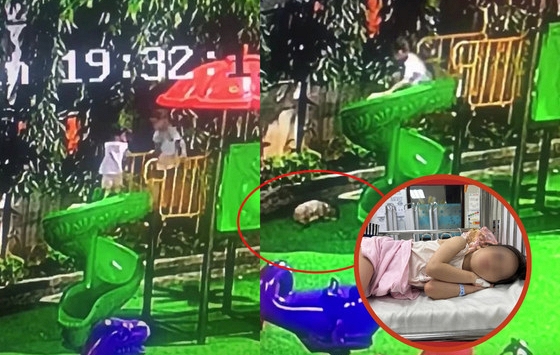 Đã tìm được gia đình bé trai đẩy ngã bé gái từ cầu trượt, nạn nhân vẫn đang được điều trị và theo dõi tích cực