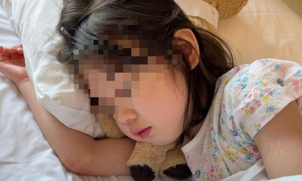 Bé gái 8 tuổi đã khổ sở vì gan nhiễm mỡ, bác sĩ tức giận: Đừng khen con thế này nữa!