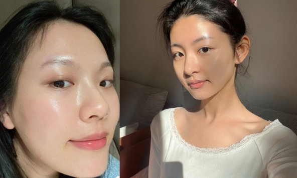Top 5 retinol chống lão hóa mạnh mẽ: Da căng mịn, tuổi tác như chậm lại