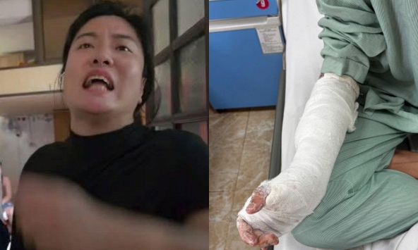 Bị khách 'bùng' tiền 30 bánh chưng, chém nhập viện: Tình trạng sức khỏe của chủ quán