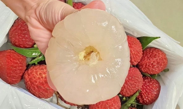 Người đàn ông suýt chết vì kiểu ăn vải ai nghe xong cũng 'sốc', bác sĩ cảnh báo 3 sai lầm chí mạng