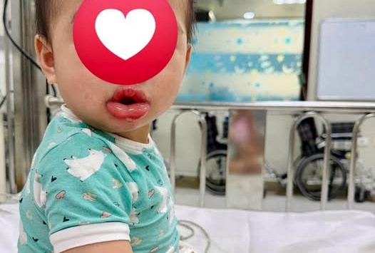Mẹ bỉm chia sẻ chuyện chỉ vì 1 giây bất cẩn với thứ hầu như nhà nào cũng có này mà suýt phải trả cái giá đắt