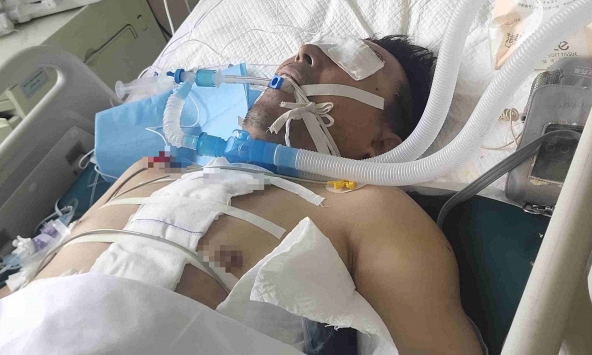 Người đàn ông nguy kịch vì trắng xóa cả 2 bên phổi: Bác sĩ cảnh báo 1 kiểu dùng điều hòa ngang 'tự sát'