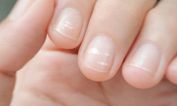 Ung thư có thể được phát hiện qua bàn tay? Bác sĩ cảnh báo: Xuất hiệu 5 dấu hiệu này, đừng nên chủ quan