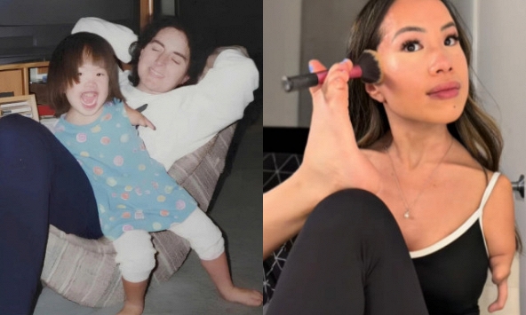 Cuộc sống khó tin của cô gái Việt không tay, được mẹ Mỹ nhận nuôi từ 7 tháng tuổi viral khắp MXH