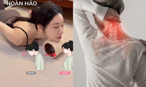 'Cổ rùa' khiến bạn già hơn cả chục tuổi: Người Hàn truyền tay nhau 4 động tác lấy lại 'cổ thiên nga' mà chỉ mất vài phút mỗi ngày