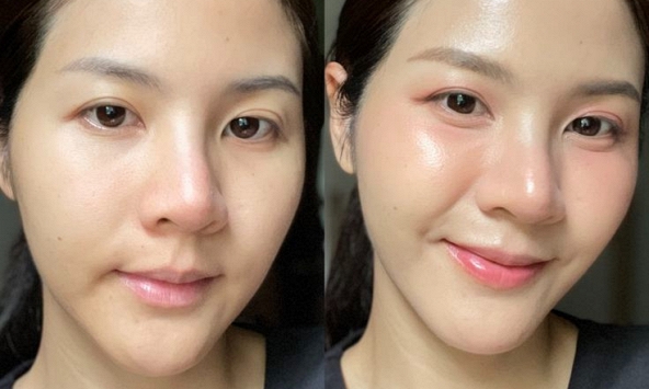 Làm 5 việc này trước khi ngủ, làn da sẽ cảm ơn bạn vào sáng hôm sau