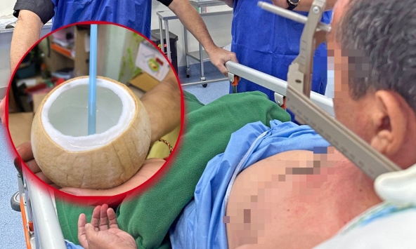 Người đàn ông tử vong sau khi uống 1 ngụm nước dừa, bác sĩ khẩn thiết: Càng mùa hè càng như 'thuốc độc'