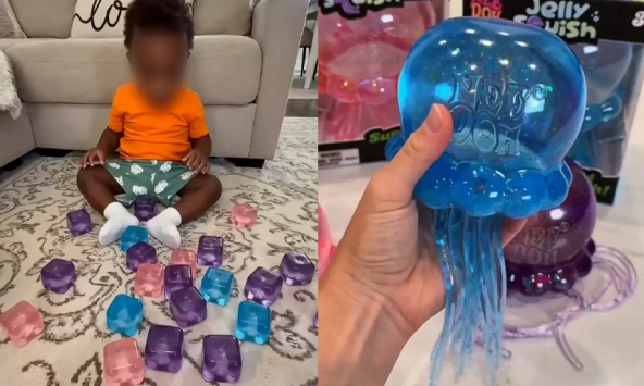 Cảnh báo về món đồ chơi hot Tiktok hàng triệu người đang mua: Con chỉ làm theo một video trên mạng, hậu quả là bỏng mặt và cánh tay