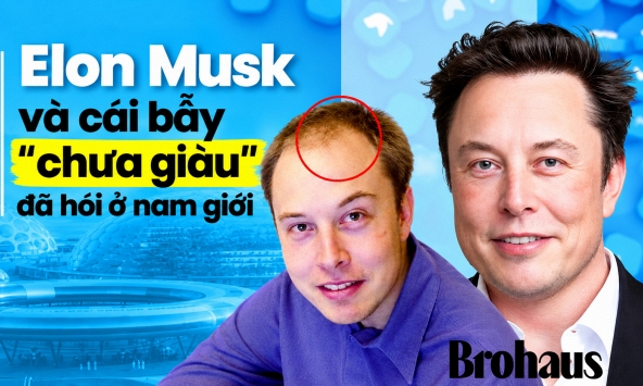 Chưa kịp giàu đã hói: Nghi vấn từ mái tóc hồi sinh của Elon Musk và cái bẫy 'cày cuốc' bóp nghẹt phong độ đàn ông