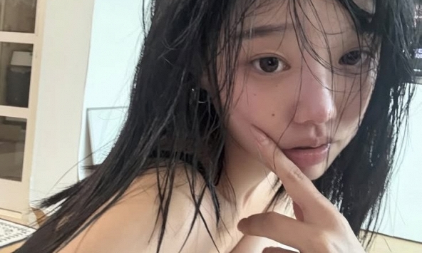 Lời khuyên cho những người hay bị ngứa 3 chỗ này trên cơ thể: Máu đã 'ngập đường'