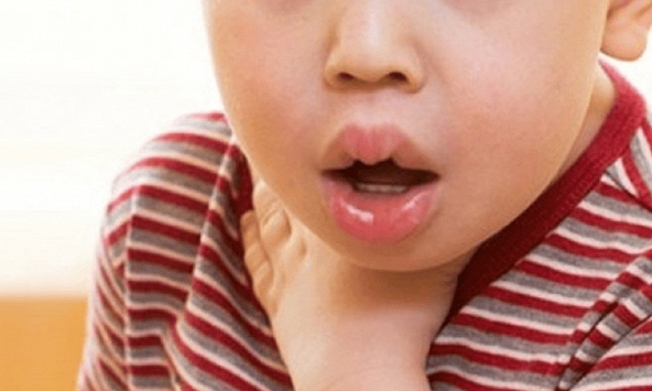 'Sát nhân' thầm lặng gây ngạt thở ở trẻ thường chỉ quanh quẩn ngay trong nhà!