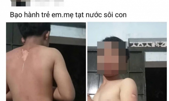 Mẹ ruột khai nguồn cơn tạt nước sôi vào người con trai, gây bỏng