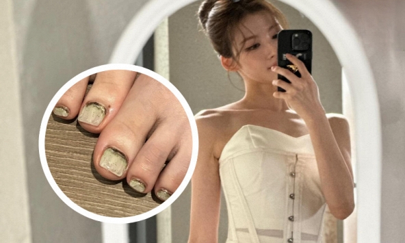 Rợn tóc gáy vì lướt trúng bộ móng chân rong rêu của mỹ nhân top 3 thế giới