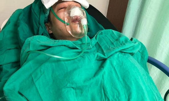 Người phụ nữ 30 tuổi sụt cân “không phanh” dù ăn uống đều đặn, đi khám phát hiện ung thư hạch và tử vong sau đó 1 năm