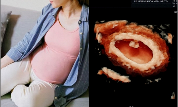 BS Nguyễn Ngọc Tú chia sẻ 8 điều ước 'giá như có ai nói sớm hơn' của 1 thai phụ khiến nhiều mẹ đồng cảm