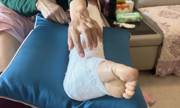 Xem nhẹ nốt ruồi ở nơi cực hiếm ai để ý, người phụ nữ 'hối không kịp' vì ung thư đã di căn