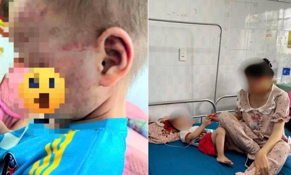 Đi làm về thấy chồng xin lỗi, vợ chết lặng khi nhìn vào mặt con, lập tức báo công an