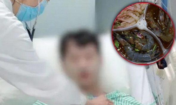 Người đàn ông suýt chết sau khi ăn hải sản theo kiểu 'vạn người mê”: Nhiễm amip ăn não, xuất huyết ruột, nhiễm trùng toàn thân