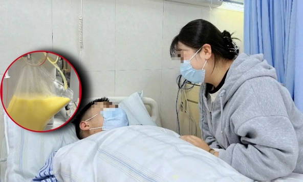 Người đàn ông 32 tuổi máu trắng tựa mỡ lợn, lưng đau như dao cứa sau 2 ngày liên tiếp ăn món thịt 'vạn người mê'