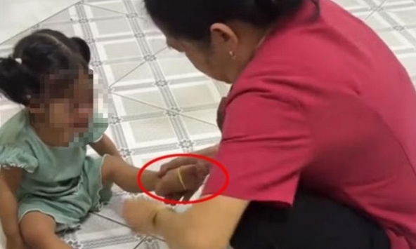 Vụ 'cô giáo mầm non' liên tục bắn dây chun vào chân bé gái: Khi niềm tin của người mẹ bị gặm nhấm bởi những con sâu mọt