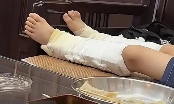 Cậu bé gãy cả hai xương gót chân vì bắt chước siêu nhân nhảy từ trên cao