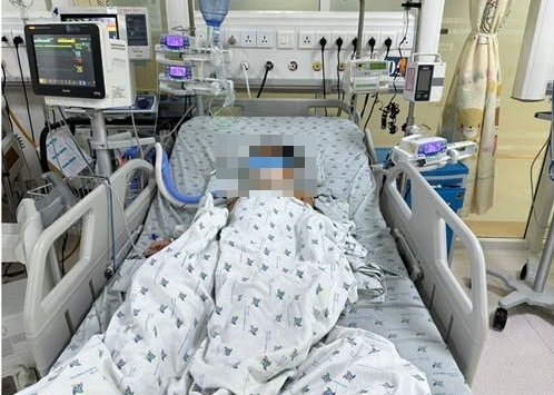 Cấp cứu 3 cháu bé bị ngộ độc nặng, ói ra máu đen, tràn máu màng phổi do ăn chuột đồng