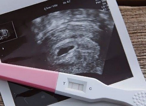 3 'cạm bẫy' lớn trên con đường chuẩn bị mang thai, mong rằng các mẹ không vấp phải