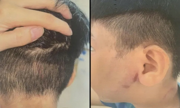 Cháu trai gọi điện cầu cứu bà ngoại vì bị bố đẻ đánh đập: Đối tượng bỏ trốn sau khi xảy ra sự việc