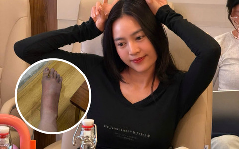 Ninh Dương Lan Ngọc mắc cúm B, chân sưng to gây lo lắng