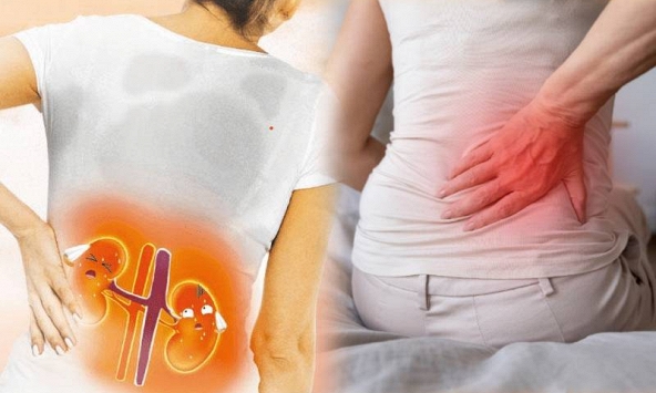 Tưởng đau lưng do ngồi nhiều, hóa ra thận cũng có thể đang “lên tiếng”: 3 điểm giúp phân biệt đau thận hay đau lưng