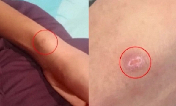 Bố mẹ đi làm xa, khi về nhà thì sốc với các vết thương trên cơ thể con trai, nghe lời kể càng bàng hoàng