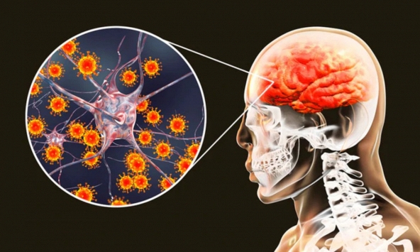 BV Bệnh Nhiệt đới Trung ương cấp cứu bé trai nhiễm virus nguy hiểm, rơi vào hôn mê chỉ sau 2 ngày
