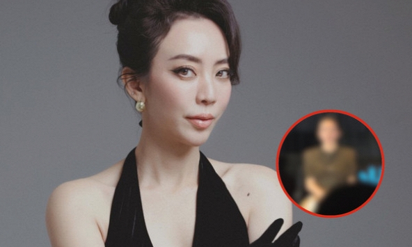 Diện mạo gây bàn tán của Thu Trang sau tai nạn phải khâu 20 mũi trên mặt