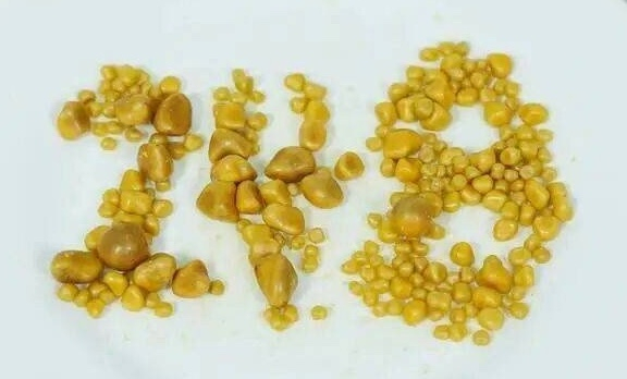 Lấy ra 248 viên sỏi từ túi mật chàng trai 26 tuổi có sở thích ăn uống “vạn người mê”