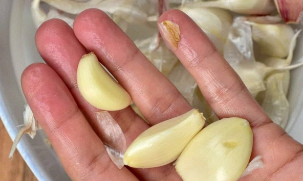 Ăn tỏi mỗi ngày để chữa viêm thận, 5 tháng sau chàng trai 28 tuổi khiến bác sĩ phải thốt lên khi khám: “Anh đã ăn gì?”