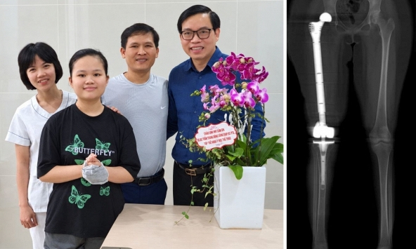 Chuyện cảm động tại lễ khai giảng VinUni: Bệnh nhân ung thư xương hội ngộ bác sĩ cứu đôi chân 5 năm trước